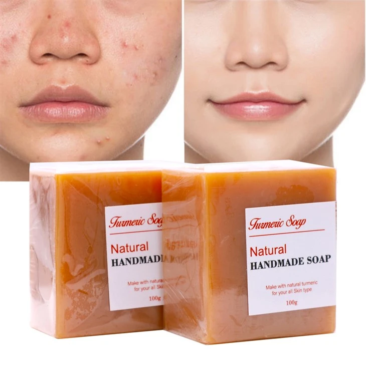 wonderful Oil Control Cleansing Soap